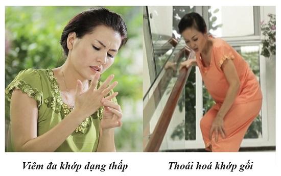 bệnh viêm đa khớp